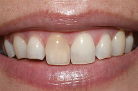 image-2-before